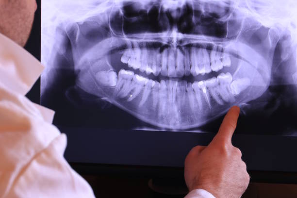 Best Emergency Tooth Extraction in Atkins, VA