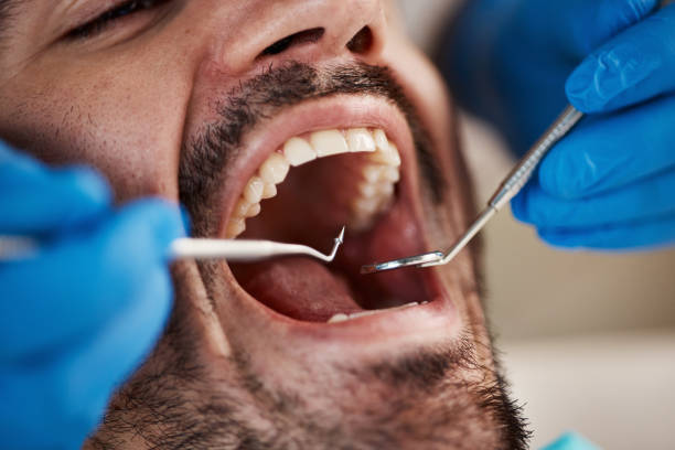 Best Emergency Denture Repair in Atkins, VA